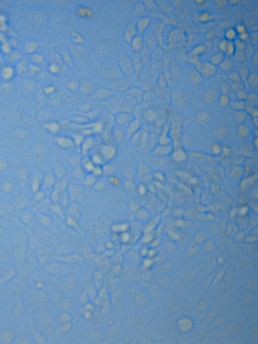Triple negative breast cancer cells magnified under a microsope at the Hopkins on the Hill research showcase in the Rayburn House Office Building in Washington, D.C., on June 12, 2025.