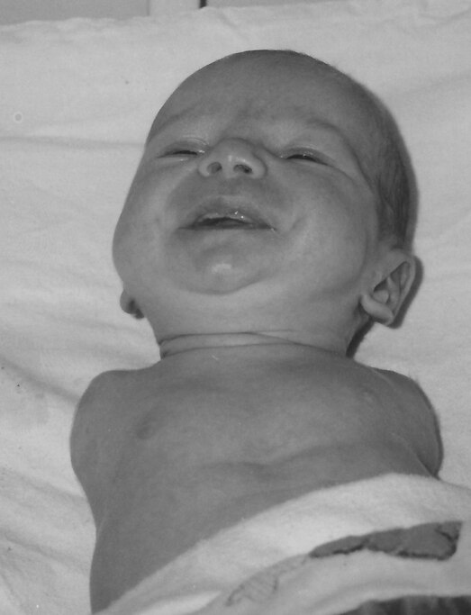 A black-and-white photo from an adoption brochure of George Dennehy as a newborn in 1994.